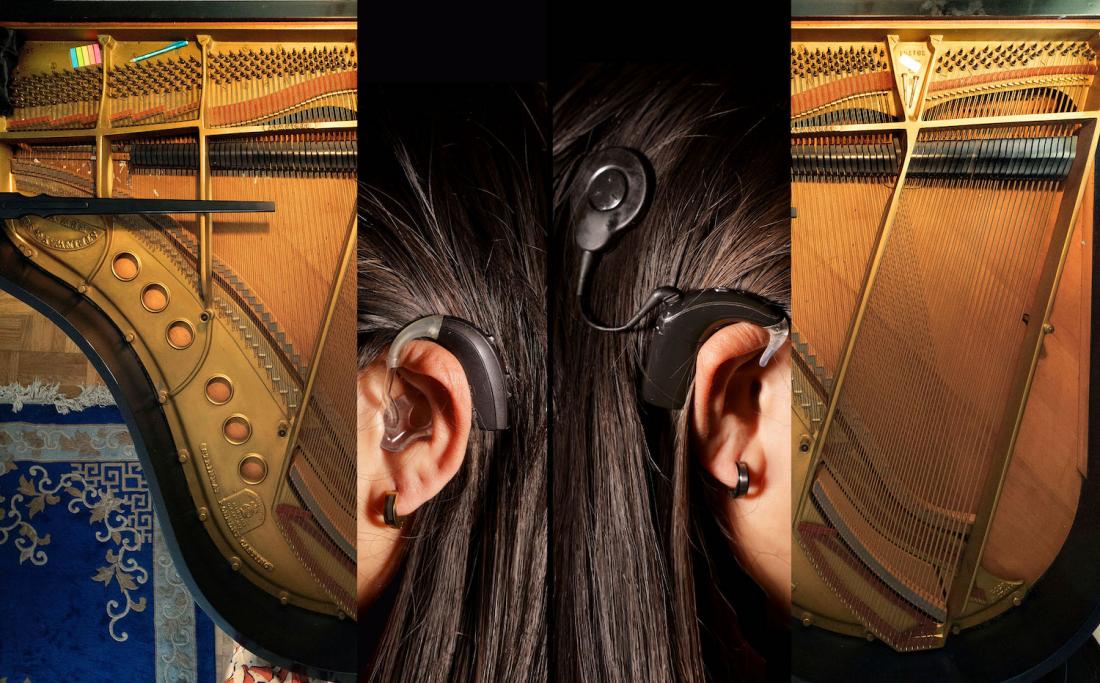 The photography is a composite of an overhead view of a grand piano with the lid open juxtaposed with left and right side view of my ears, one wearing a hearing aid and the other a cochlear processor.